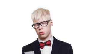 Albino young man in suit with mobile isolated.