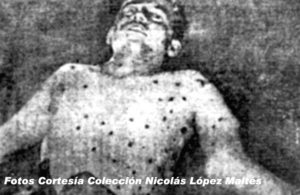 El cuerpo de Rigoberto López Pérez, autor de los disparos contra Somoza García, recibió culatazos, escupitajos, patadas y 54 tiros de todo tipos de arma. 