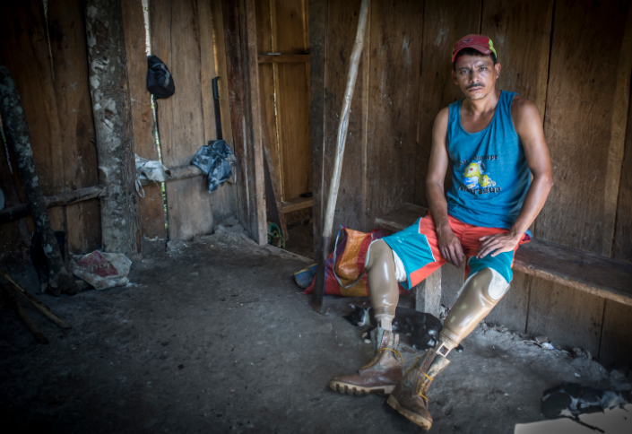 Al campesino Juan Lanzas la violencia perpetrada por la Policía Nacional le arrancó las piernas. Hoy trata de rehacer su vida. LA PRENSA/Oscar Navarrete