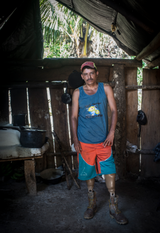 Luego de que le amputaron las piernas a Lanzas, el obispo de Matagalpa, Rolando Álvarez, visitó a la familia y señaló que tras el acto brutal contra este campesino “el pueblo debe de alzar su voz y pedir justicia. LA PRENSA/O. Navarrete