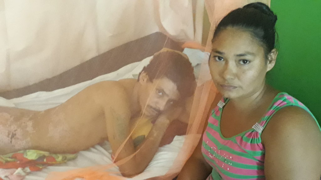 Luego de que le amputaron las piernas, el campesino pensó que nunca volvería a caminar. LA PRENSA/Archivo